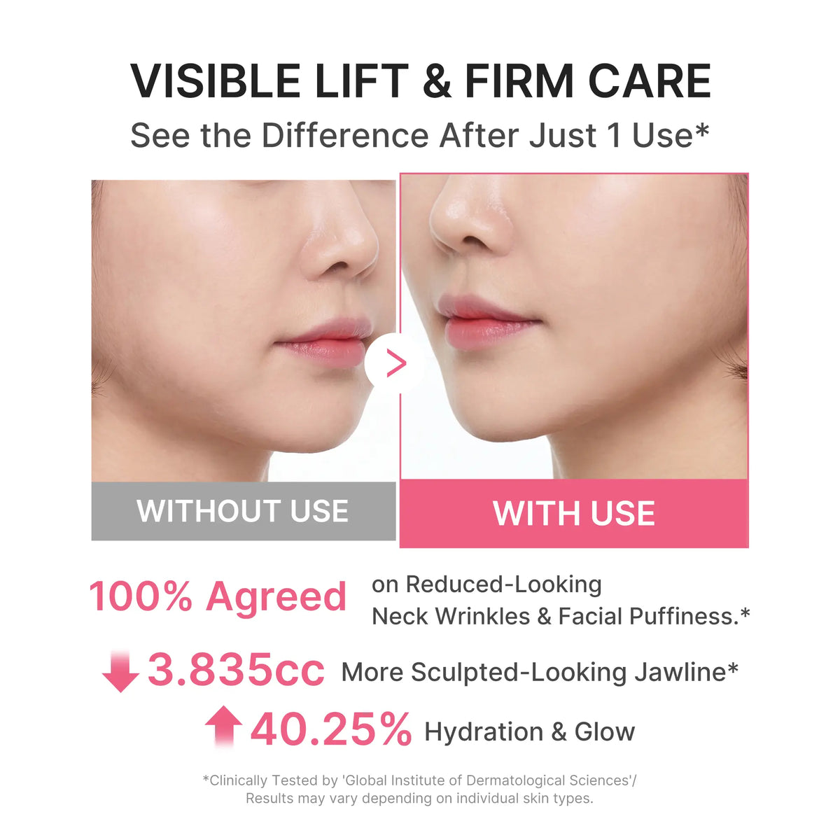 Medicube PDRN Collagen Gua Sha Neck Wrinkle Cream with Built-In Massager | Formulated with 5% Volufiline and PDRN for Firming and Contouring | Targets Fine Lines on Neck, Jawline, Décolleté, Underarms, Chest, Legs, and Shoulders | Korean Skincare Solution